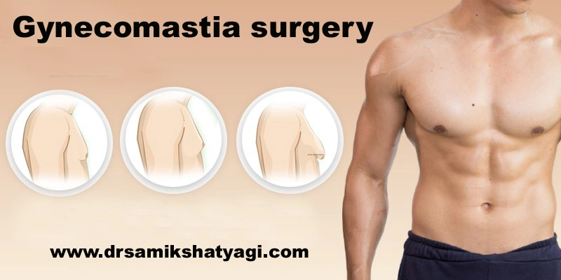 Gynecomastia surgery Near me