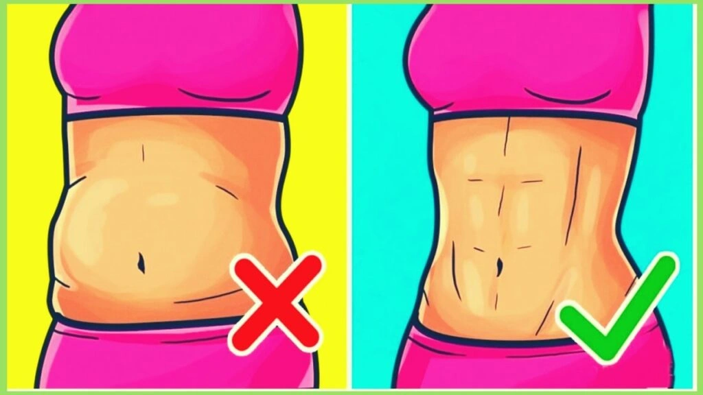 How to Lose Tummy Fat Effectively: Understanding Your Options Including Liposuction in Noida
