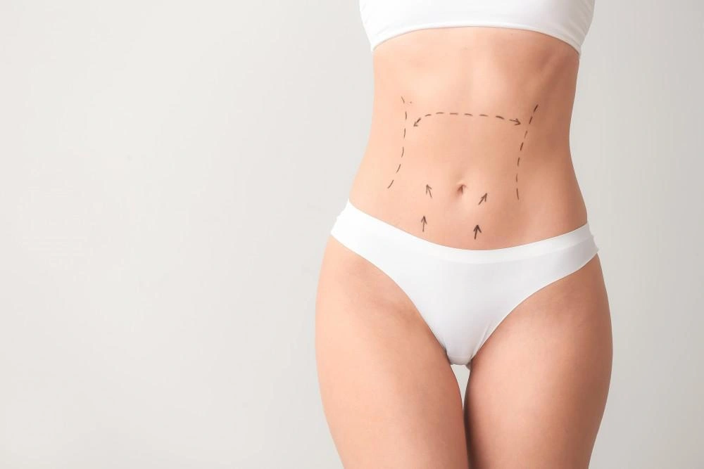 Liposuction Surgery in Noida: Safe & Effective Body Contouring Explained