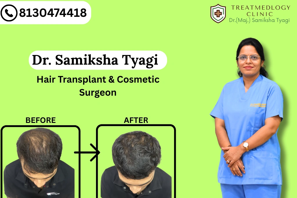 Affordable Hair Transplant in Noida: Is Low Cost Always the Best Option?