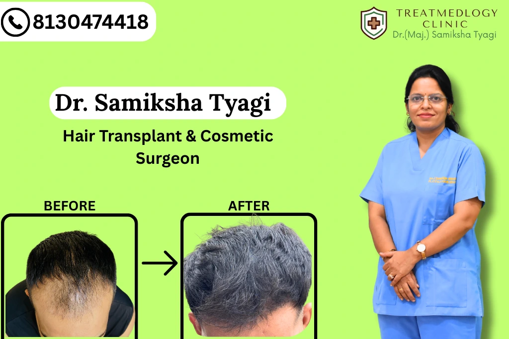 From Bald to Bold: Real Transformations After Hair Transplant in Noida