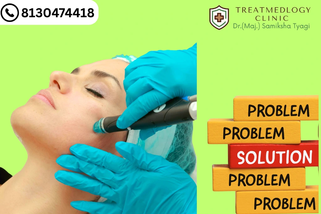 Acne Scar Treatment: Best Medical & Surgical Solutions
