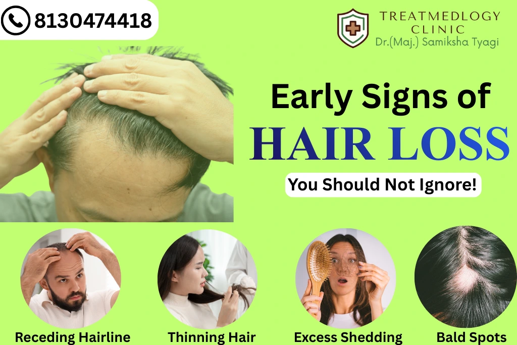 Early Signs of Hair Loss You Should Not Ignore